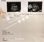 Private photos of a Beijing couple leaked