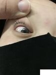 MJ 부드러운 유치원 교사, 바늘 튜브를 통한 주입, 흑백 스타킹을 번갈아 가며 놀기