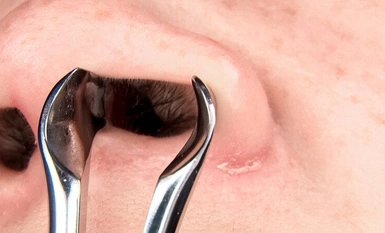 EVIS-521 美鼻的高粘度鼻涕