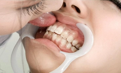 EVIS-519 Đồng tính nữ liếm răng