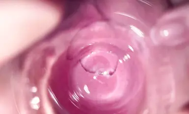 Camera sa loob ng teen cream pussy ni Mia_3